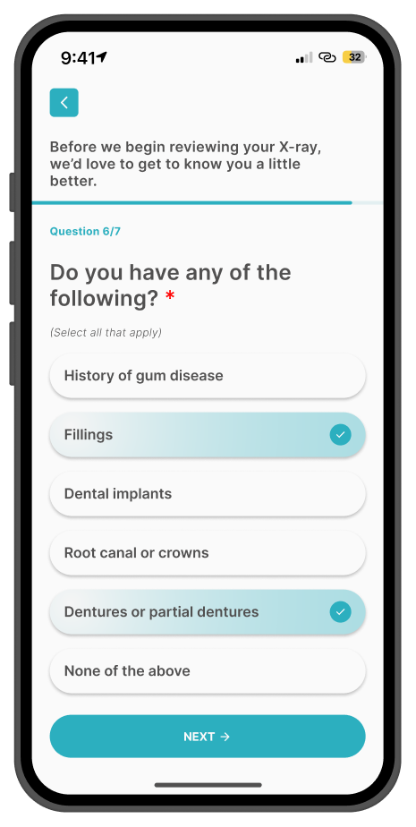 Perio ai onboarding quiz screen — question 6 of 7 asking whether the user has a history of gum disease, fillings, dental implants, root canal or crowns, or dentures